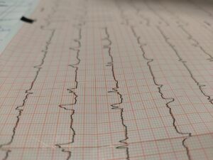 てんかんの発作に関する体験や口コミはどこで見つけられる？